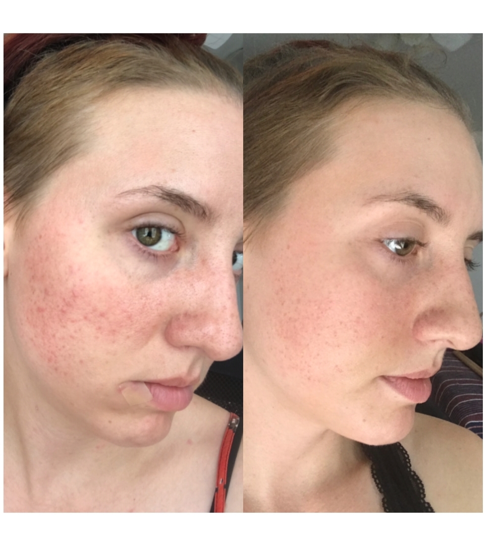 تونر گلایکولیک اسید اوردینری روشن کننده صورت و بدن